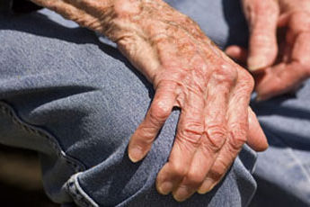 Artriidi tagajärjel organismis tekkiv proteiin kaitseb Alzheimeri tõve eest