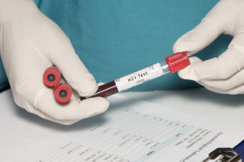 HIV vaktsiin näitas esimest korda inimkatsetes piisavat tõhusust