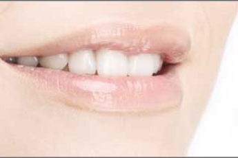3 kuldreeglit, mis ennetavad hambavalu ja hambaaukude teket