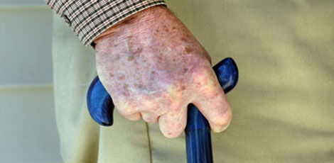 Mitme tegevuse üheaegne sooritamine suurendab Parkinsoni tõve põdejatel kukkumise riski