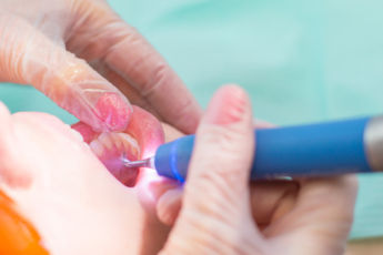 Hambaarstid nurisevad: patsient võiks saada vähemalt ühe hambaaugu riigi kulul parandatud