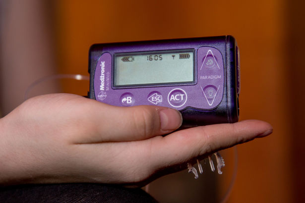 Riik hakkab hüvitama laste kaasaegseid insulinipumpasid