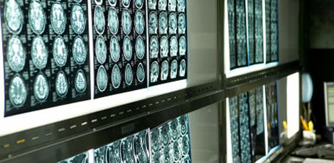 Röntgenuuringuga võivad paljud murrud märkamata jääda