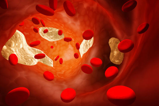 Üldkolesterool alla 5 mmol/L